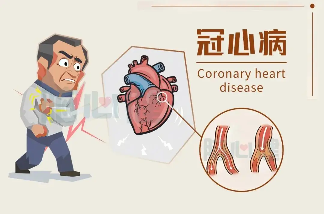 冠心病患者的飲食原則、健康食物推薦及食療攻略